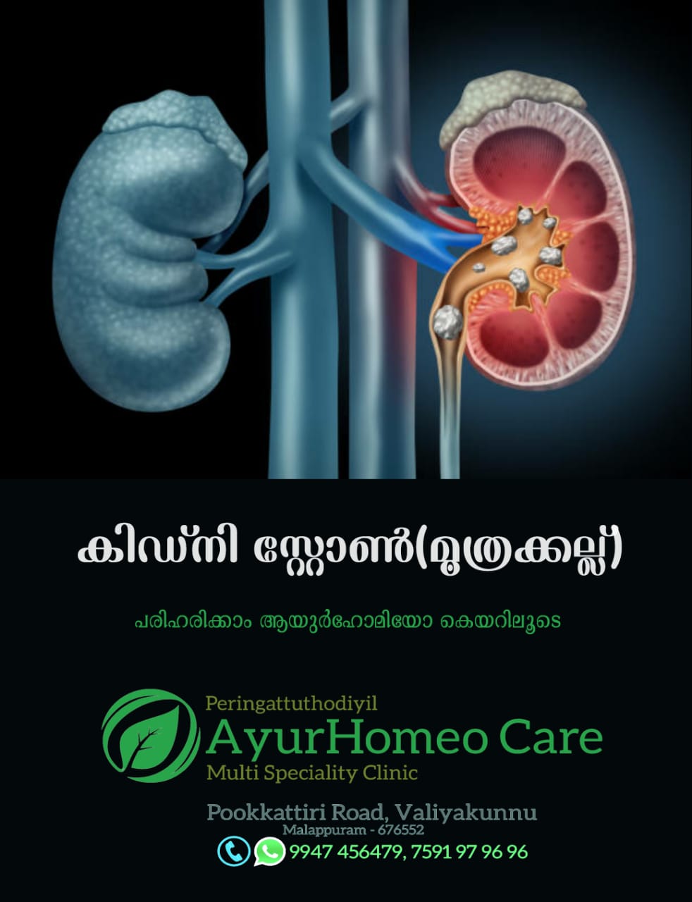 AyurHomeo Care Valiyakunnu Irimbiliyam